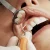 جرمگیری لثه با جرمگیری دندان چه فرقی دارد؟